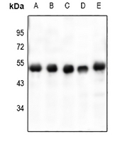 1 - Anti-VASP (Phospho-S238) Antibody AP60525
