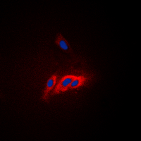 3 - Anti-WASP (Phospho-Y290) Antibody AP60526