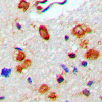 19 - Anti-WASP (Phospho-Y290) Antibody AP60526