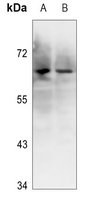 1 - Anti-Ku70 (Phospho-S5) Antibody AP60527