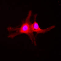 3 - Anti-SGK1 (Phospho-S422) Antibody AP60528