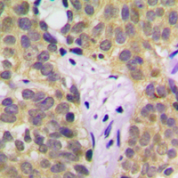 19 - Anti-SGK1 (Phospho-S422) Antibody AP60528