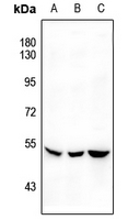 1 - Anti-SGK1 (Phospho-S422) Antibody AP60528