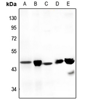 1 - Anti-Septin 3 Antibody AP60529