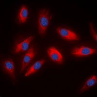 3 - Anti-ACLY Antibody AP60530