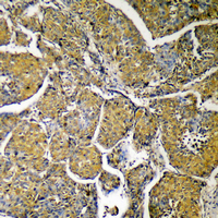 19 - Anti-ACLY Antibody AP60530