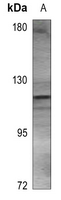 1 - Anti-ACLY Antibody AP60530