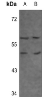 1 - Anti-Adenosine A3 Receptor Antibody AP60531