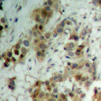 19 - Anti-AKT (Phospho-T450) Antibody AP60532