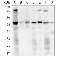 1 - Anti-AKT (Phospho-T450) Antibody AP60532