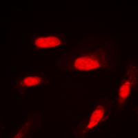 3 - Anti-AKT (Phospho-S246) Antibody AP60533
