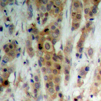 19 - Anti-AKT (Phospho-S246) Antibody AP60533
