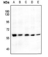 1 - Anti-AKT (Phospho-S246) Antibody AP60533