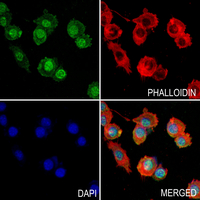 3 - Anti-Annexin A1 (Phospho-Y21) Antibody AP60534