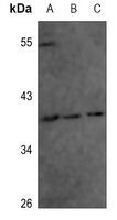 1 - Anti-Annexin A1 (Phospho-Y21) Antibody AP60534