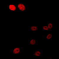 3 - Anti-Androgen Receptor (Phospho-S213) Antibody AP60535