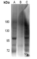 1 - Anti-Androgen Receptor (Phospho-S213) Antibody AP60535