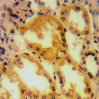 19 - Anti-A-RAF Antibody AP60536