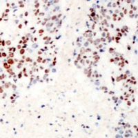 19 - Anti-ATF2 (Phospho-S62) Antibody AP60538