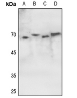 1 - Anti-ATF2 (Phospho-S62) Antibody AP60538