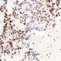 19 - Anti-ATF2 (Phospho-T71) Antibody AP60539