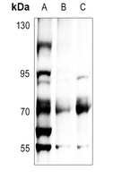 1 - Anti-ATF2 (Phospho-T71) Antibody AP60539