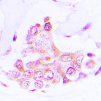 19 - Anti-ATP5H Antibody AP60540