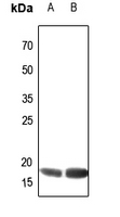 1 - Anti-ATP5H Antibody AP60540