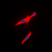 3 - Anti-Vasopressin V2 Receptor Antibody AP60541