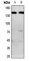 1 - Anti-BAI1 Antibody AP60542