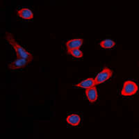 3 - Anti-BDKRB1 Antibody AP60543
