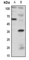 1 - Anti-BDKRB1 Antibody AP60543