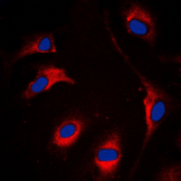 3 - Anti-BMX Antibody AP60544