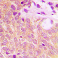 19 - Anti-BMX Antibody AP60544