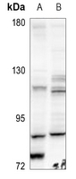 1 - Anti-BMX Antibody AP60544