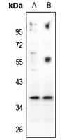 1 - Anti-CD88 Antibody AP60545