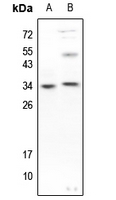 1 - Anti-Caspase 3 (Phospho-S150) Antibody AP60546