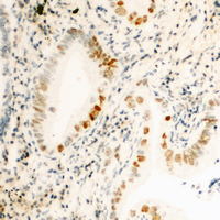 19 - Anti-Cyclin H (Phospho-T315) Antibody AP60548
