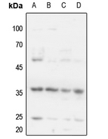 1 - Anti-Cyclin H (Phospho-T315) Antibody AP60548