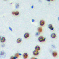 19 - Anti-CDCA4 Antibody AP60550