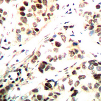 19 - Anti-CHK1 (Phospho-S296) Antibody AP60551