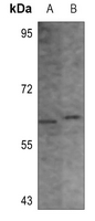 1 - Anti-CHK1 (Phospho-S296) Antibody AP60551