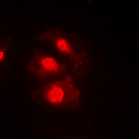 3 - Anti-CHK1 (Phospho-S345) Antibody AP60552