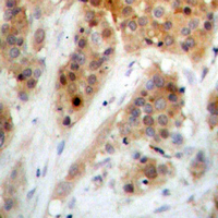 19 - Anti-CHK1 (Phospho-S345) Antibody AP60552