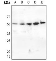 1 - Anti-CHK1 (Phospho-S345) Antibody AP60552
