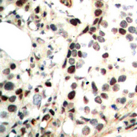19 - Anti-CHK2 (Phospho-T68) Antibody AP60553