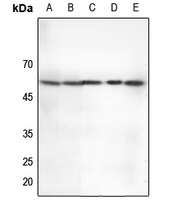 1 - Anti-CHK2 (Phospho-T68) Antibody AP60553