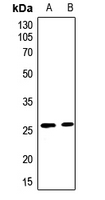 1 - Anti-CLIC3 Antibody AP60554