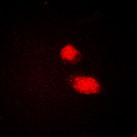 3 - Anti-CMPK1 Antibody AP60555