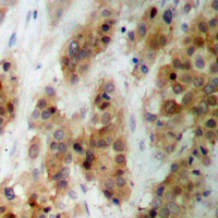 19 - Anti-CMPK1 Antibody AP60555